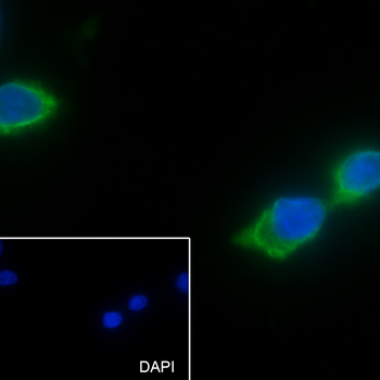 TSHB antibody