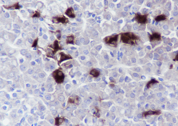 TSHB antibody