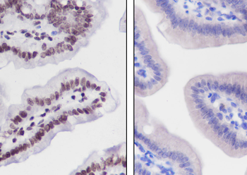 Crotonyl-Histone H2B (Lys11) antibody