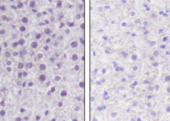 Crotonyl-Histone H2B (Lys11) antibody