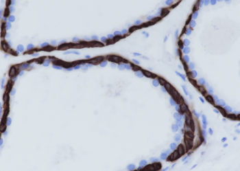 Keratin 14 antibody