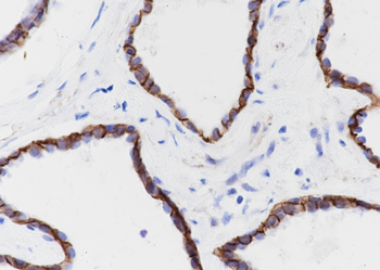 delta 1 Catenin antibody