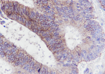 CLDN1 antibody