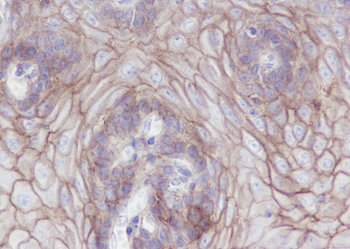 CLDN1 antibody