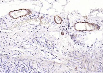 pan (alpha) actin antibody