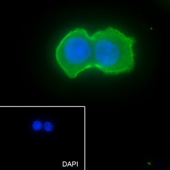 pan (alpha) actin antibody