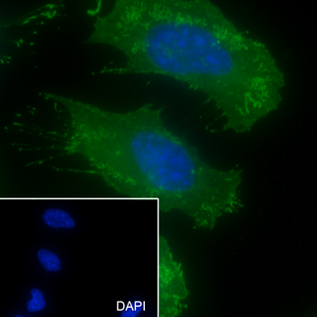 pan (alpha) actin antibody