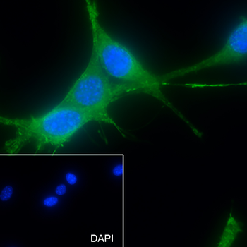 pan (alpha) actin antibody