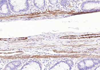 pan (alpha) actin antibody