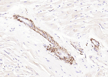 pan (alpha) actin antibody