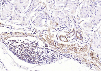 pan (alpha) actin antibody