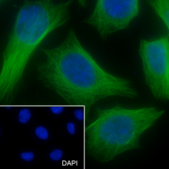 IDH1 antibody