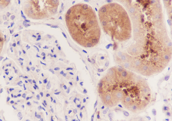 IDH1 antibody