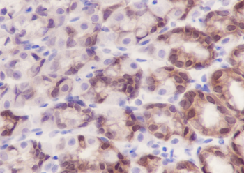 IDH1 antibody