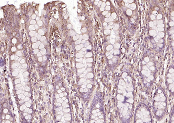 P4HB antibody