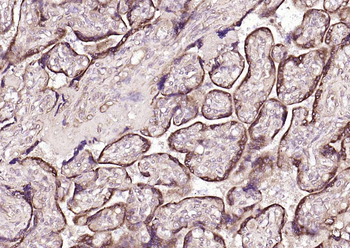 P4HB antibody