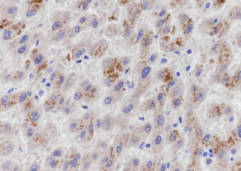 PCK1 antibody