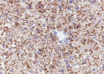 PCK1 antibody