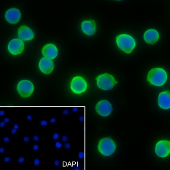 ALDOA antibody