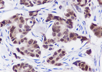 FOXA1 antibody