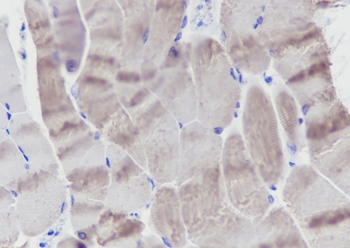 MYL3 antibody