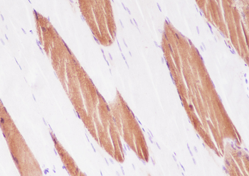 myosin light chain 3 antibody