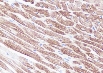 myosin light chain 3 antibody