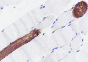 myosin light chain 3 antibody