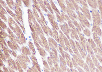 myosin light chain 3 antibody