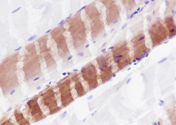 myosin light chain 3 antibody