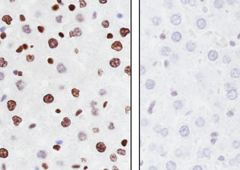 Malonyl-Histone H3 (Lys122) antibody