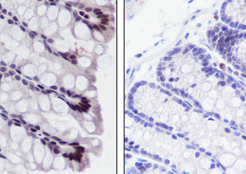 Propionyl-Histone H3 (Lys56) antibody