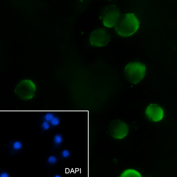 RAN antibody