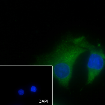 GCK antibody