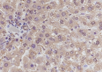 GCK antibody