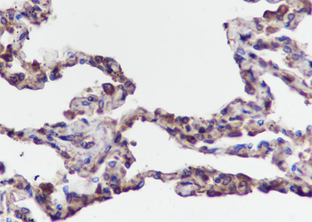 TMEM111 antibody