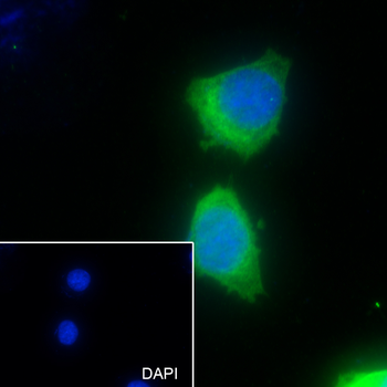 PKC Gamma antibody