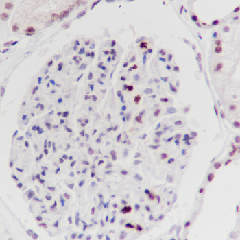 Histone H3 (Phospho-Ser10) antibody