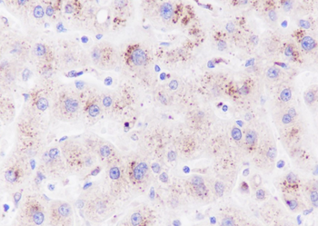 CPS1 antibody