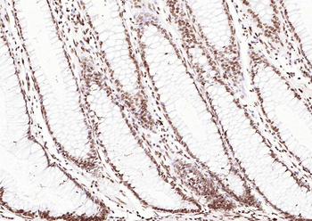 ERCC1 antibody