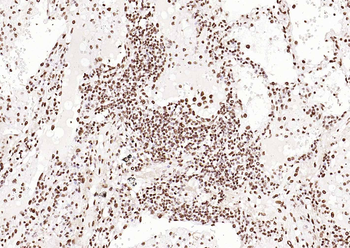 ERCC1 antibody