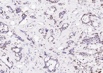 ERCC1 antibody