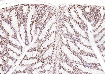 ERCC1 antibody