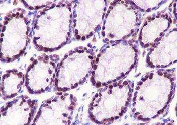 MCM3 antibody