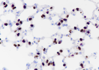 Thyroid Transcription Factor-1 antibody