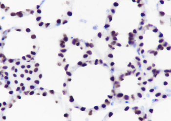 Thyroid Transcription Factor-1 antibody