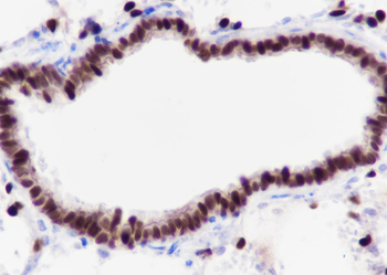 Thyroid Transcription Factor-1 antibody