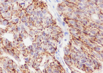 CLDN7 antibody