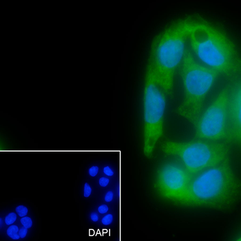 14-3-3 Recombinant Mouse mAb