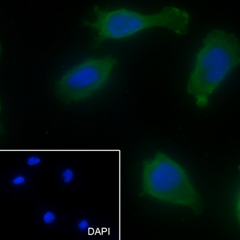 BTC antibody